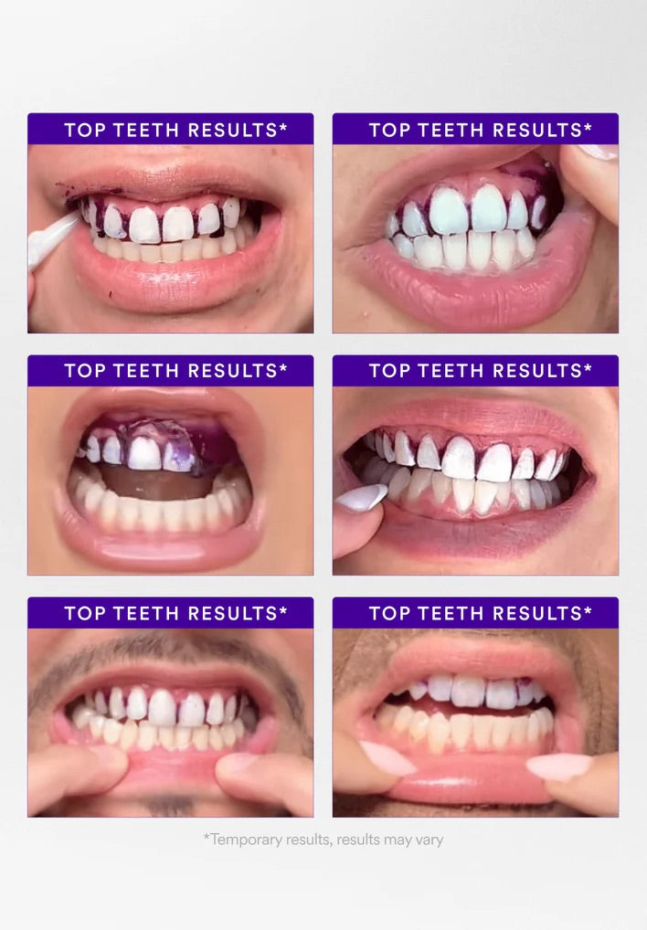 Ibtisamati V34 Purple Strips